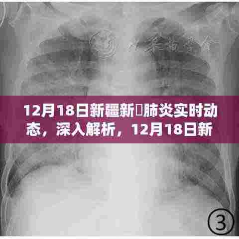 12月18日新疆新冠肺炎实时动态深度解析与应用评测