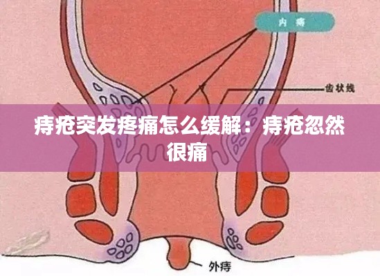 痔疮突发疼痛怎么缓解:痔疮忽然很痛