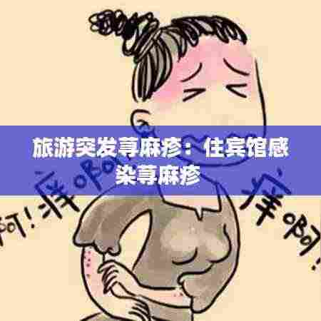 旅游突发荨麻疹:住宾馆感染荨麻疹