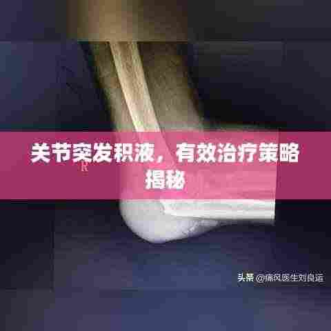 关节突发积液,有效治疗策略揭秘