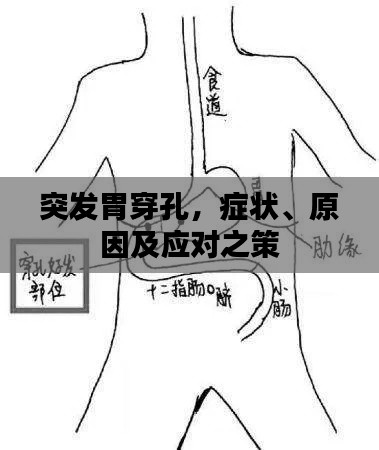 突发胃穿孔,症状、原因及应对之策